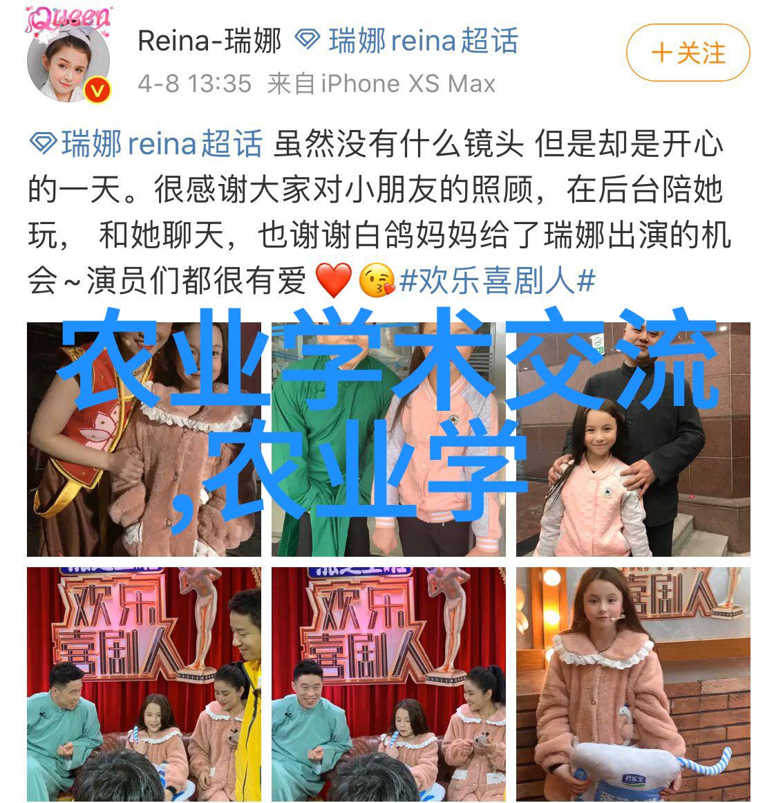 在kyson的世界里猪旋毛虫病就像一条隐形的蚯蚓它悄无声息地侵入了猪群的安全之中只有当症状如皮肤瘙痒